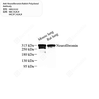Антитела первичные, поликлональные кролика к Neurofibromin крысы, мыши, человека, 50 мкл