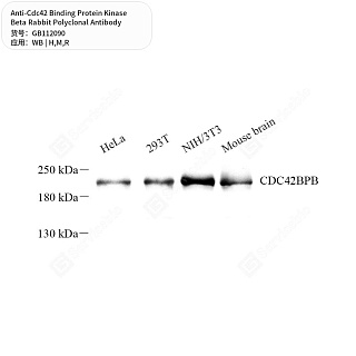 Антитела первичные, пол. кролика к Cdc42 Binding Protein Kinase Beta крысы, мыши, человека, 50 мкл