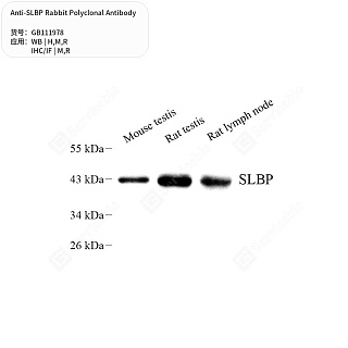 Антитела первичные, поликлональные кролика к SLBP крысы, мыши, человека, 50 мкл