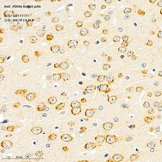 Антитела первичные, поликлональные кролика к PDIA6 крысы, мыши, человека, 100 мкл
