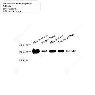 Антитела первичные, поликлональные кролика к Occludin крысы, мыши, человека, 50 мкл