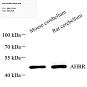 Антитела первичные, поликлональные, AHRR, 100 мкл