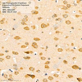 Антитела первичные, поликл. кролика к Prostaglandin D Synthase (Lipocalin)/PDS крысы, мыши, 50 мкл