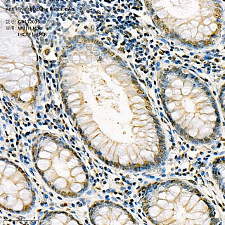 Антитела первичные, поликлональные кролика к Transketolase крысы, мыши, человека, 100 мкл