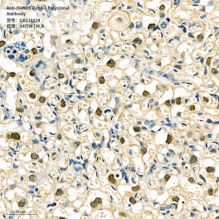 Антитела первичные, поликлональные кролика к HAND1 крысы, мыши, 50 мкл