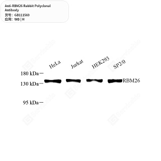 Антитела первичные, поликлональные кролика к RBM26 человека, 50 мкл