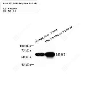 Антитела первичные, поликлональные кролика к MMP2 мыши, человека, 50 мкл