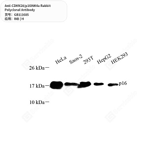 Антитела первичные, поликлональные кролика к CDKN2A/p16INK4a человека, 50 мкл
