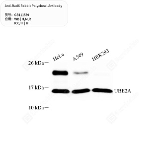 Антитела первичные, поликлональные кролика к Rad6 крысы, мыши, человека, 50 мкл