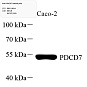 Антитела первичные, поликлональные, CCT3, 100 мкл