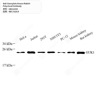 Антитела первичные, поликлональные кролика к Guanylate kinase крысы, мыши, человека, 50 мкл