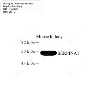 Антитела первичные, поликлональные кролика к alpha 1 Antitrypsin мыши, 50 мкл