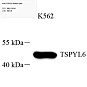 Антитела первичные, поликлональные, TSPYL6, 100 мкл