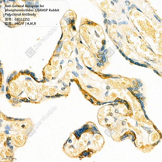 Антитела первичные, пол. крол. к General Receptor for phosph. 1/GRASP крысы, мыши, чел., 50 мкл