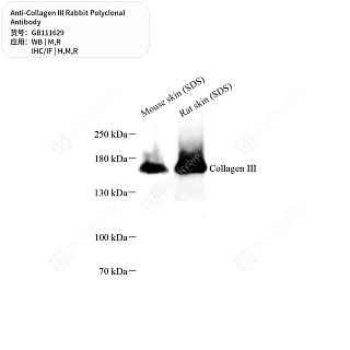 Антитела первичные, поликлональные кролика к Collagen III крысы, мыши, человека, 50 мкл