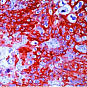 Антитела первичные, моноклональные Cytokeratin 14, 500 мкл