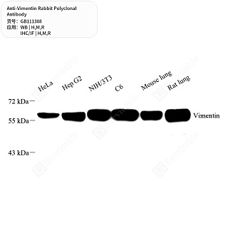 Антитела первичные, поликлональные кролика к Vimentin крысы, мыши, человека, 50 мкл