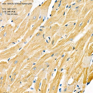 Антитела первичные, поликлональные кролика к SERCA2 ATPase крысы, мыши, 100 мкл
