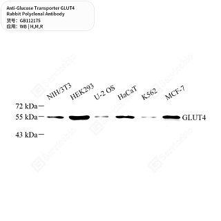 Антитела первичные, поликл. кролика к Glucose Transporter GLUT4 крысы, мыши, человека, 50 мкл