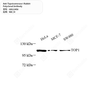 Антитела первичные, поликлональные кролика к Topoisomerase I человека, 50 мкл