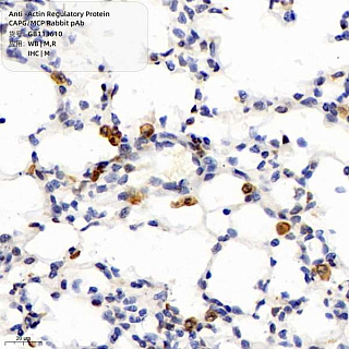 Антитела первичные, поликлональные кролика к Actin Regulatory Protein CAPG/MCP крысы, мыши, 100 мкл