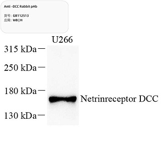 Антитела первичные, поликлональные кролика к DCC человека, 100 мкл