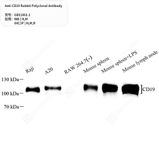 Антитела первичные, поликлональные кролика к CD19 крысы, мыши, человека, 50 мкл