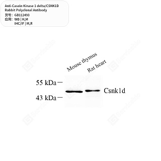 Антитела первичные, поликл. кролика к Casein Kinase 1 delta/CSNK1D крысы, мыши, человека, 50 мкл