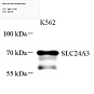 Антитела первичные, поликлональные, SLC24A3, 100 мкл