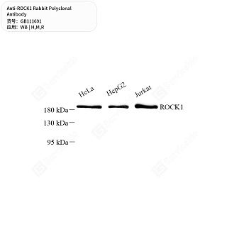Антитела первичные, поликлональные кролика к ROCK1 крысы, мыши, человека, 50 мкл