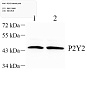 Антитела первичные, поликлональные, P2Y2, 100 мкл