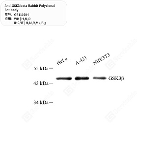 Антитела первичные, поликл. кролика к GSK3 beta крысы, мыши, обезьяны, свиньи, человека, 50 мкл