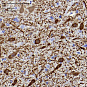 Антитела первичные, моноклональные, Tyrosine Hydroxylase, 100 мкл