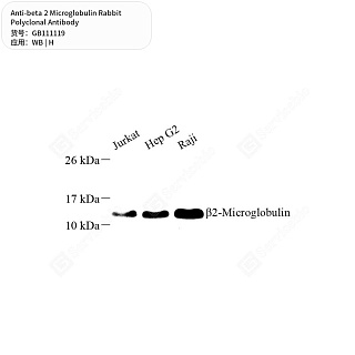 Антитела первичные, поликлональные кролика к beta 2 Microglobulin человека, 50 мкл