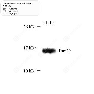 Антитела первичные, поликлональные кролика к TOMM20 крысы, мыши, человека, 50 мкл