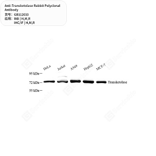 Антитела первичные, поликлональные кролика к Transketolase крысы, мыши, человека, 50 мкл