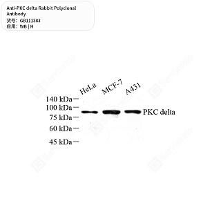 Антитела первичные, поликлональные кролика к PKC delta человека, 50 мкл