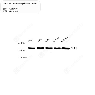 Антитела первичные, поликлональные кролика к GNB1 крысы, мыши, человека, 50 мкл
