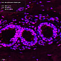 Антитела первичные, поликлональные, Neurofibromin, 100 мкл