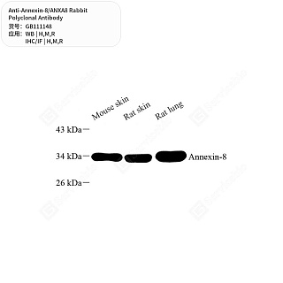 Антитела первичные, поликлональные кролика к Annexin-8/ANXA8 крысы, мыши, человека, 50 мкл