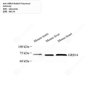 Антитела первичные, поликлональные кролика к GRB14 мыши, 50 мкл