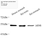 Антитела первичные, поликлональные, Asparagine synthetase, 100 мкл