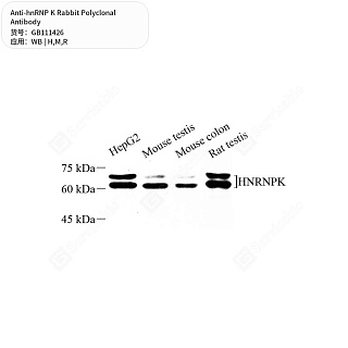 Антитела первичные, поликлональные кролика к hnRNP K крысы, мыши, человека, 50 мкл