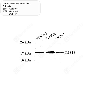 Антитела первичные, поликлональные кролика к RPS18 крысы, мыши, человека, 50 мкл