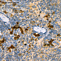 Антитела первичные, поликлональные, NF2/Merlin, 100 мкл