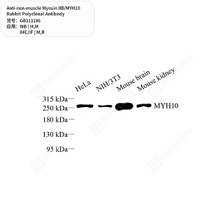Антитела первичные, поликл. кролика к non-muscle Myosin IIB/MYH10 крысы, мыши, человека, 50 мкл