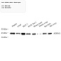 Антитела первичные, поликлональные, ADRM1/ARM-1, 100 мкл