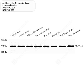 Антитела первичные, поликлональные кролика к Dopamine Transporter крысы, мыши, 50 мкл