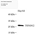 Антитела первичные, поликлональные, TSPAN12, 100 мкл
