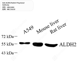 Антитела первичные, поликлональные кролика к ALDH2 крысы, мыши, человека, 50 мкл